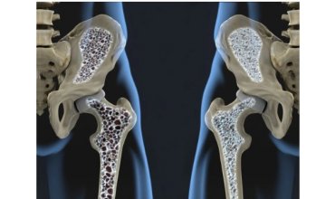 Imagen Enfermedades óseas metabólicas: fisiopatología, diagnóstico y tratamiento 2026